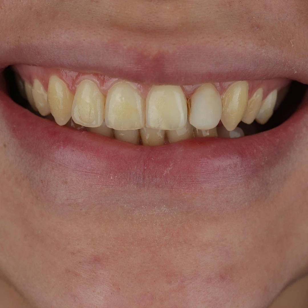 Before After Dental Treatment (9)